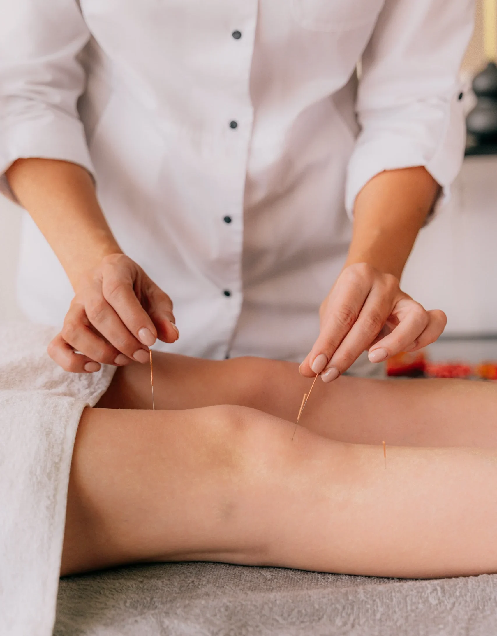 L'acupuncture est une médecine énergétique globale et individuelle, préventive et curative.